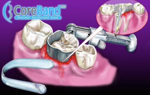 Logo design & Dental illustration for a new product